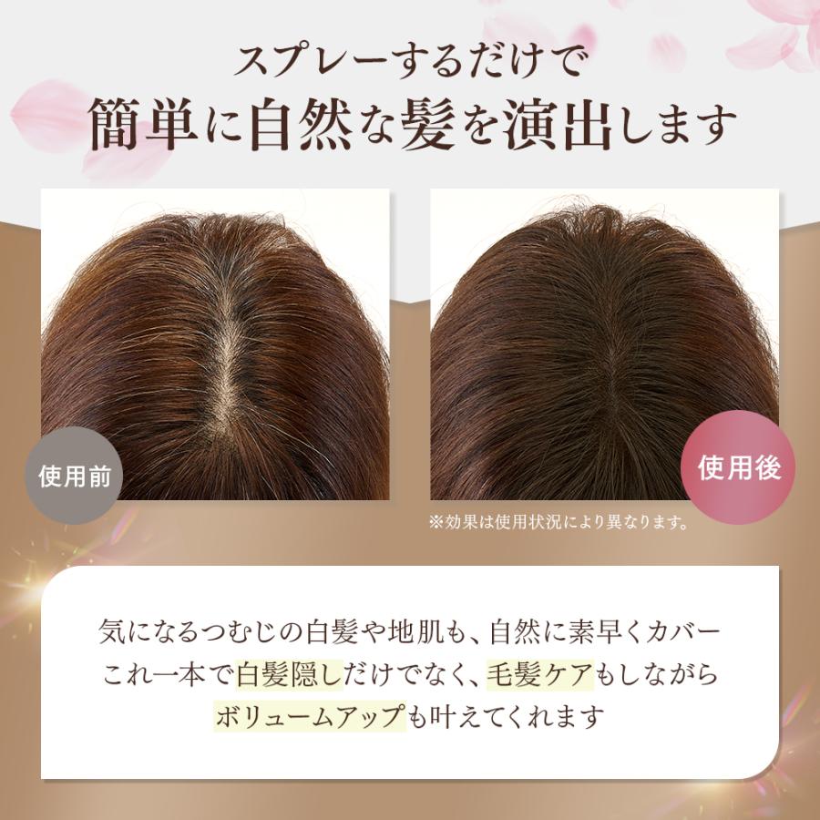 アイメディア ヘアフォロー ブラウン 3本セット 正規品 生え際 つむじ