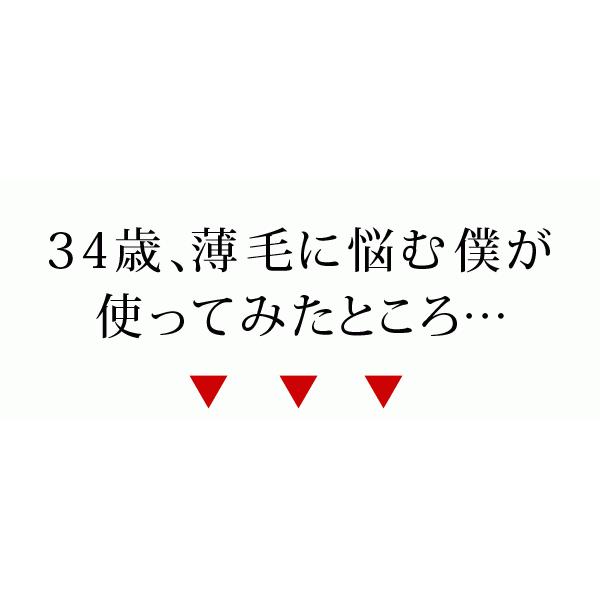 newヘアフォロー ブラウン 5本セット 正規品 生え際 つむじはげ 分け目部分 薄毛をカバー 白髪隠し はげ隠しスプレー 送料無料｜le-cure｜04