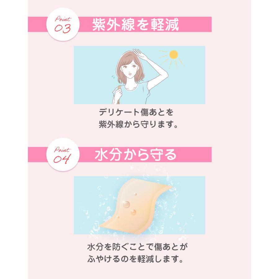 傷あとケアテープ ケロイド テープ 傷あとケア用シリコンジェルシート 手術後 帝王切開 (Lサイズ 5cm×16cm ) |  | 04