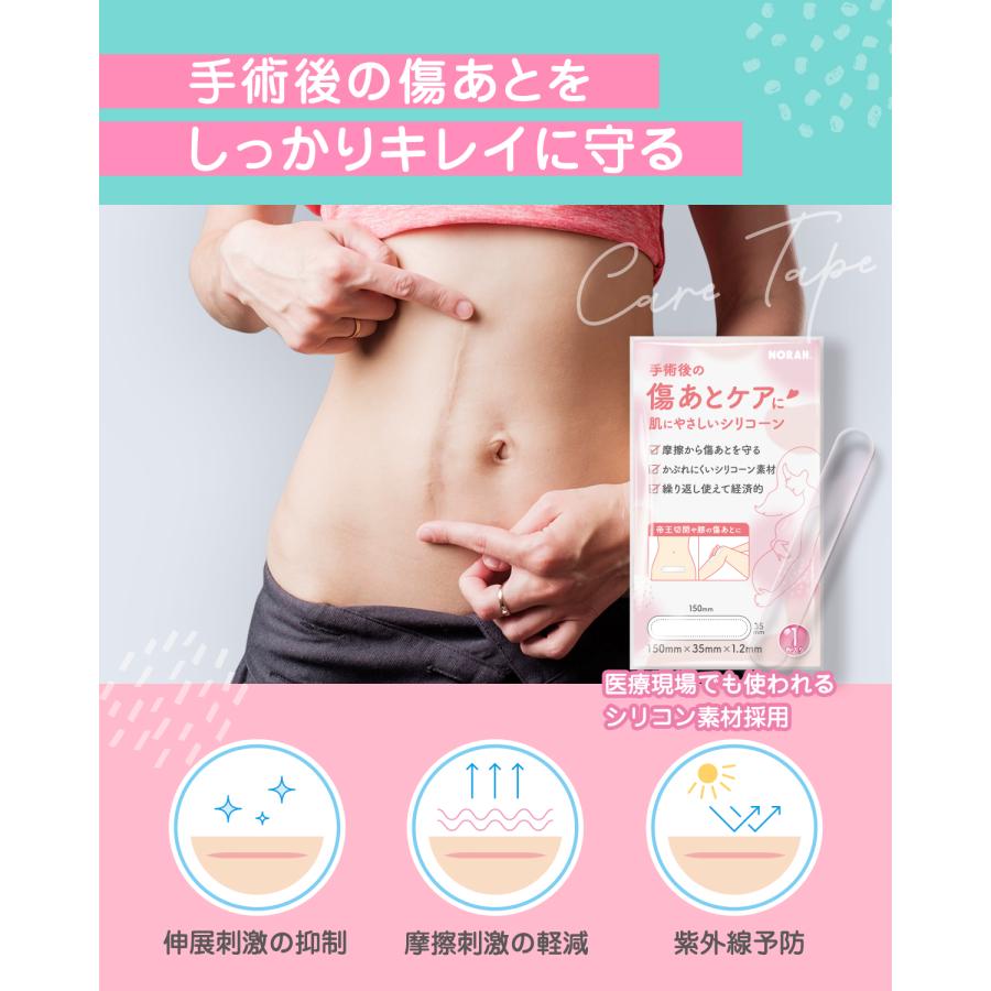 傷あとケアシリコーンシート ケロイド 傷あとケア用シリコンジェルシート 手術後 帝王切開 3本セット |  | 01