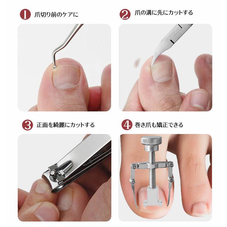 爪切り ニッパー 巻き爪 矯正 サポート 器具 硬い爪 ネイルケア 肥厚爪