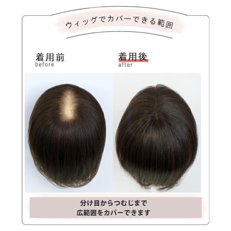 【2,000円クーポン】返品・色交換OK 分け目Lサイズ Web限定商品 部分ウィッグ 頭頂部 ヘアピース 女性用 カバー かつら 簡単 ボリュームアップ 40代 50代 60代の画像