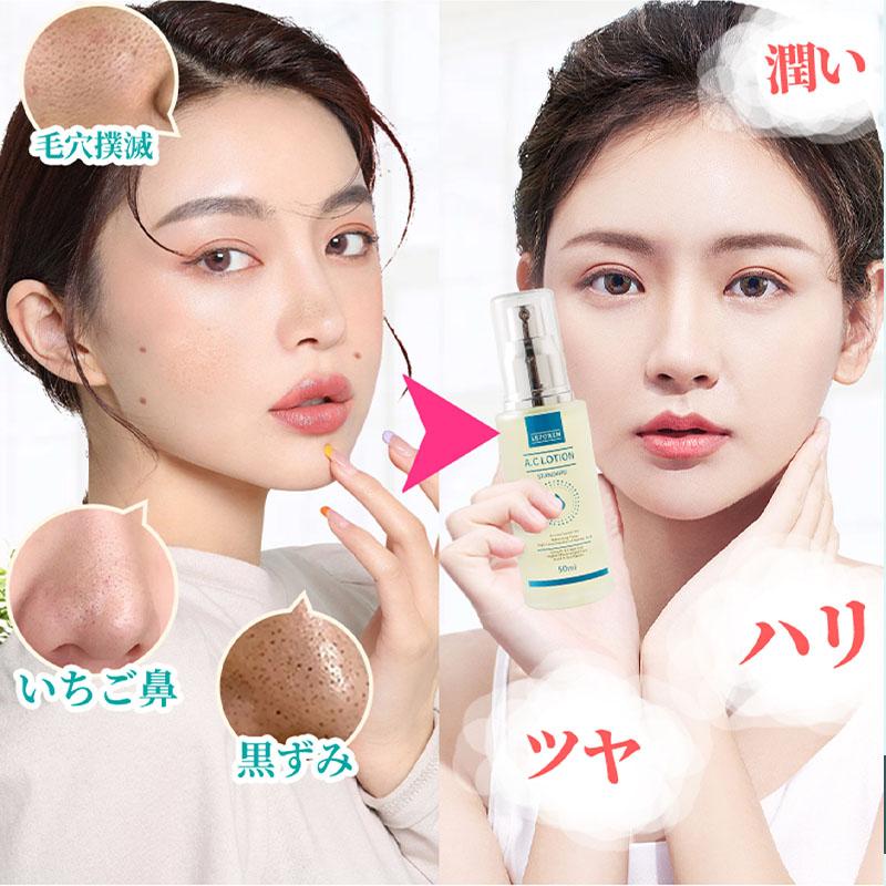 LEPOREM アゼライン酸8%配合 A.Cシリーズ アゼライン酸 LEPOREM アゼライン酸8%配合 A.Cシリーズ アゼライン酸