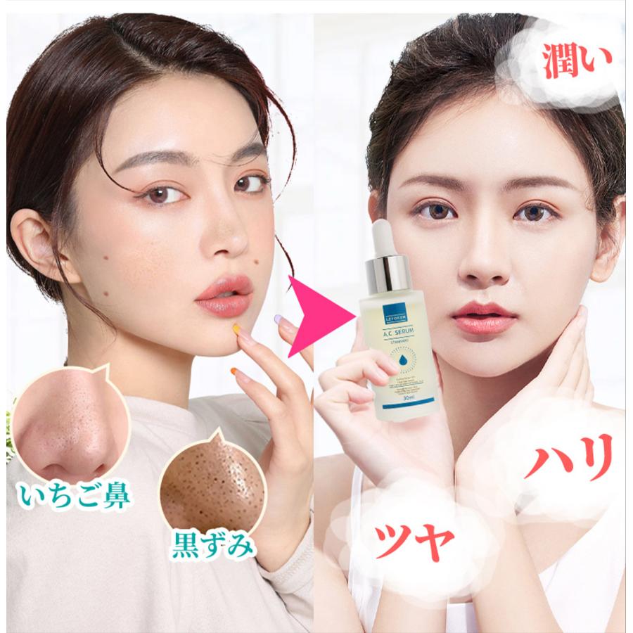 LEPOREM 美容液 アゼライン酸10%配合 A.Cシリーズ アゼライン酸 LEPOREM 美容液 アゼライン酸10%配合 A.Cシリーズ アゼライン酸