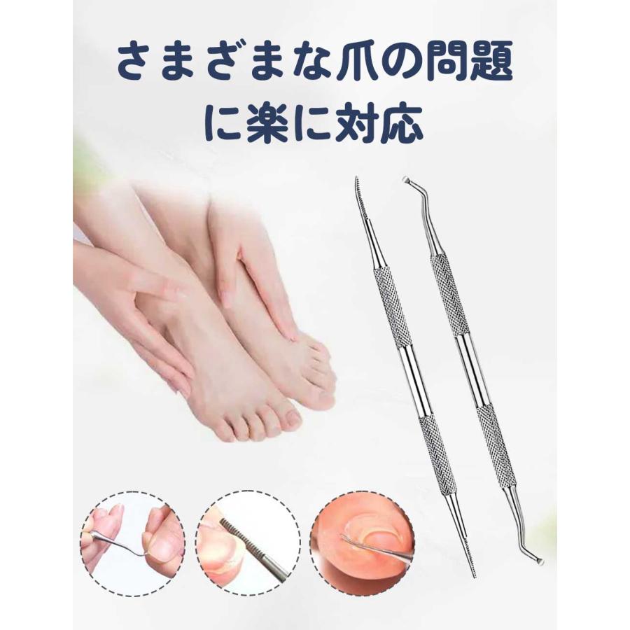 巻き爪専門院院長監修 2025最新版】ゾンデ 爪垢取り 甘皮処理