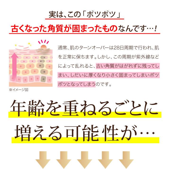 イポケア イボ 除去 イボ取り イボ取り (１０本セット) お肌 皮膚 首 ポツポツ 美容液 角質取り 首イボ はとむぎ いぼ 自分で 角質 イポケアEX 18ml_3