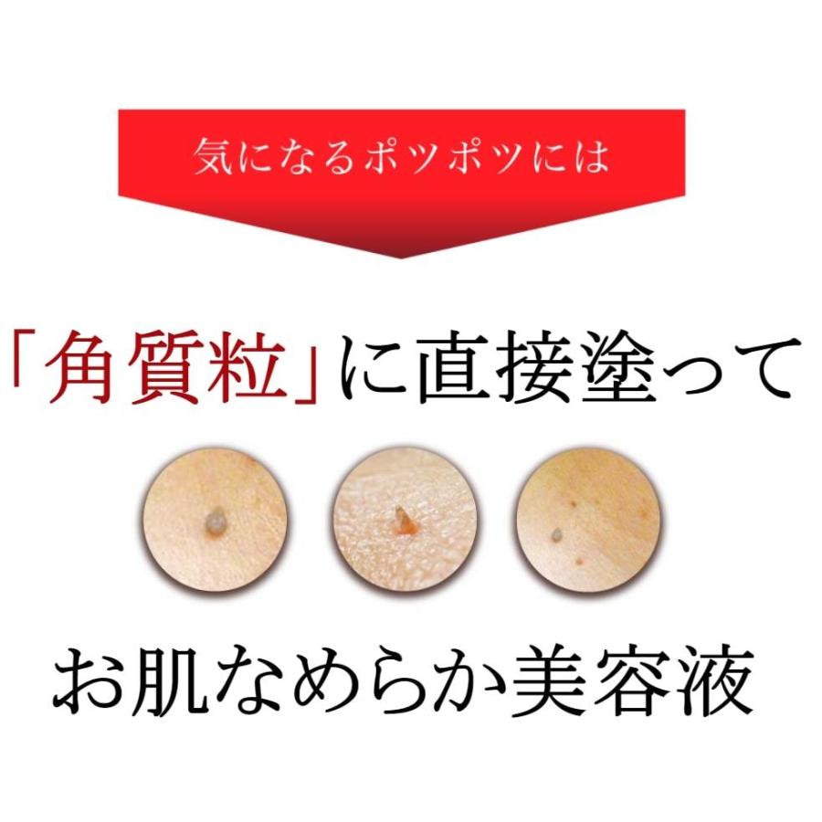イポケア イボ 除去 イボ取り イボ取り (１０本セット) お肌 皮膚 首 ポツポツ 美容液 角質取り 首イボ はとむぎ いぼ 自分で 角質 イポケアEX 18ml_4