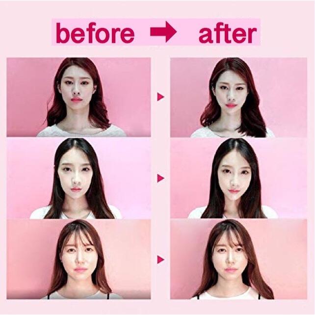 ゆかりん ○韓国発 小顔テープ 80枚♪貼るだけで小顔 Amazon. ゆかりん