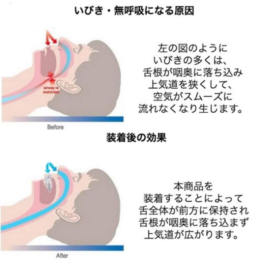 舌用マウスピース 鼻呼吸 いびき防止 グッズ 快眠 いびき 舌 マウスピース 送料無料｜lifehancer｜03