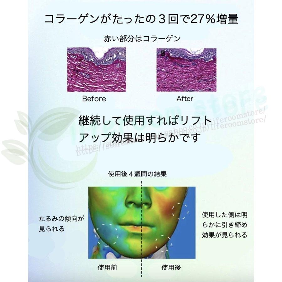 【超美品】 メソセラピーガン メソガン MTSメソガン マイクロニードルセラピーシステム（MTS） 【2219041929】(11900円)