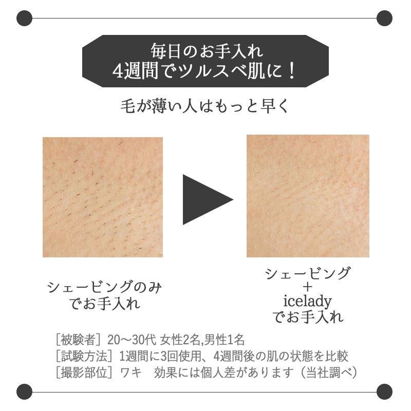 Notime icelady アイスレディ 全身脱毛器 家庭用光美容器 SKB Notime icelady アイスレディ 全身脱毛器 家庭用光美容器 SKB