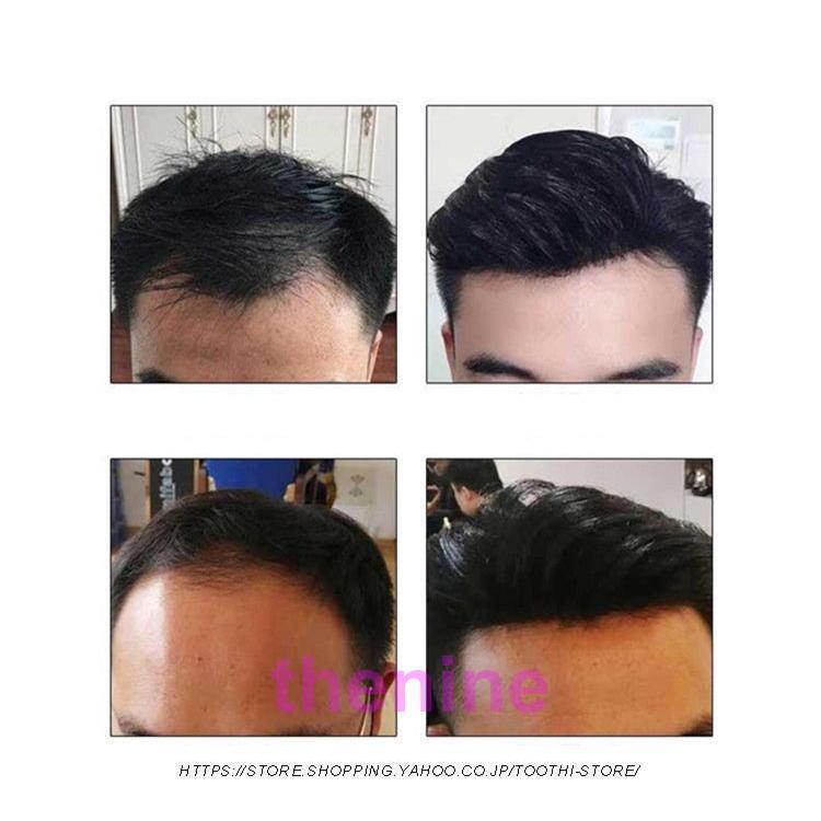 人毛100％ メンズウィッグ 部分ウィッグ ハーフウィッグ つけ毛 男性用ウイッグ 自然 ウイッグ エクステンション かつら イメチェン ボリュームアップ |  | 04
