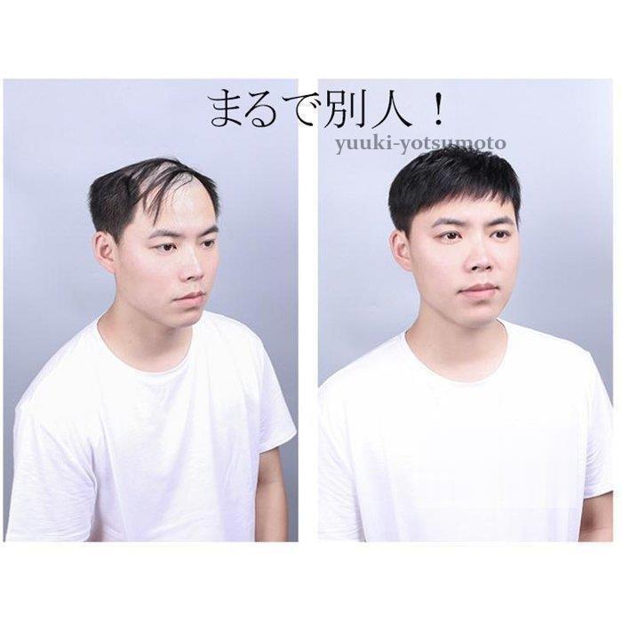 ウィッグ 男性用 かつら 人毛ウィッグ 中年 自然黒 ブラック 日常用 かつら 人毛かつら メンズヘア ショート お父さんに |  | 10