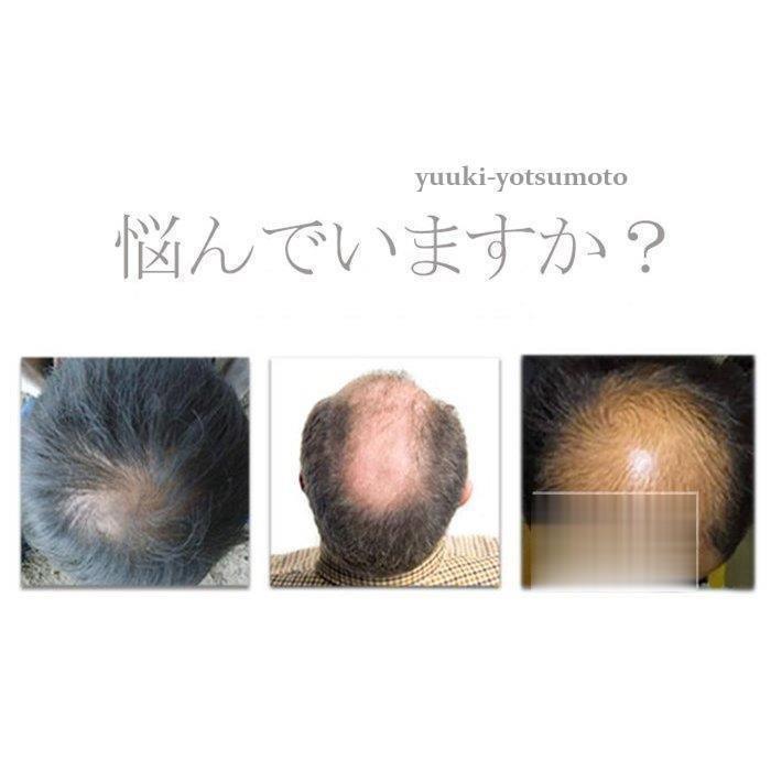 ウィッグ 男性用 かつら 人毛ウィッグ 中年 自然黒 ブラック 日常用 かつら 人毛かつら メンズヘア ショート お父さんに |  | 03