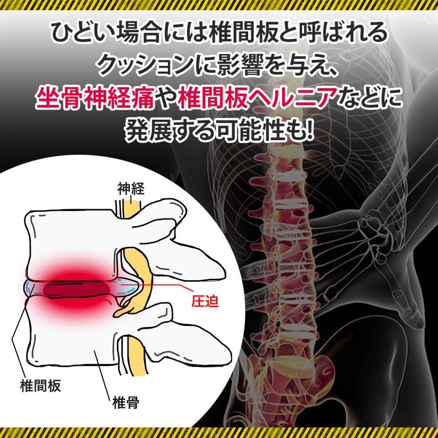 腰痛ベルト 腰サポーター  サポートベルト スポーツ用  腰用ベルト コルセット 腰痛 骨盤ベルト ヘルニア｜linoshopmk｜06