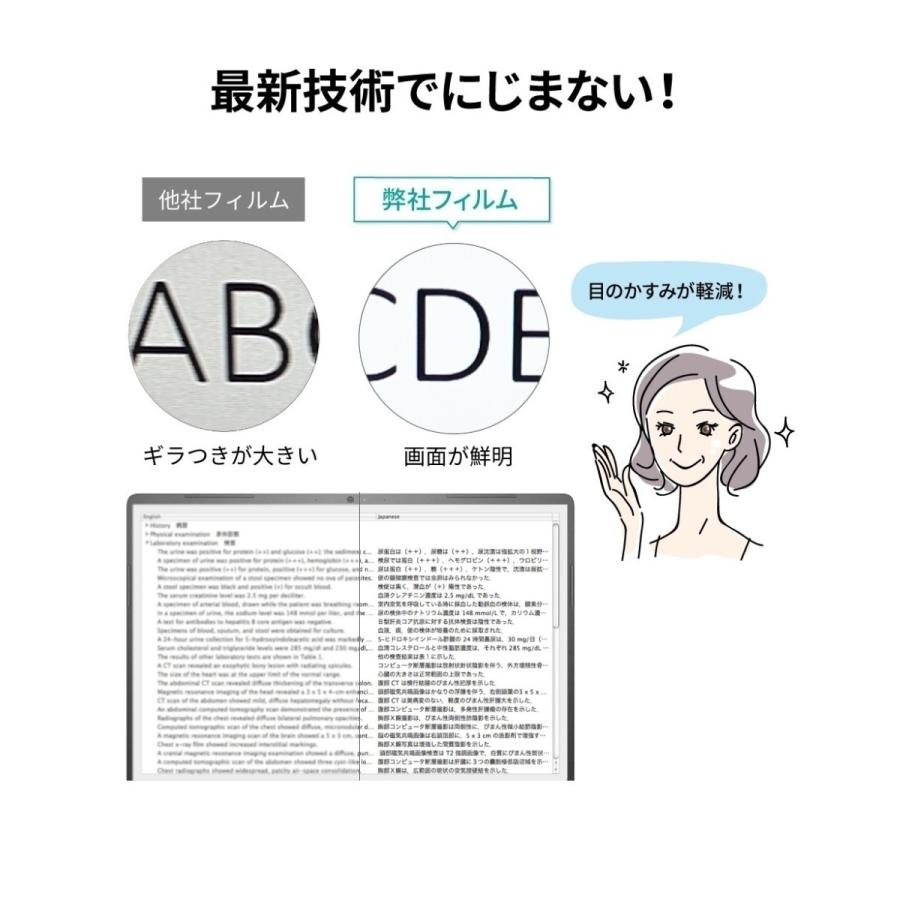 15.6インチ 16：9 汎用 ノートパソコン 保護フィルム 反射防止 ギラついたり文字がにじんだりしない アンチグレア 純日本製 スーパーAGフィルム Dell Lenovo｜loe｜05