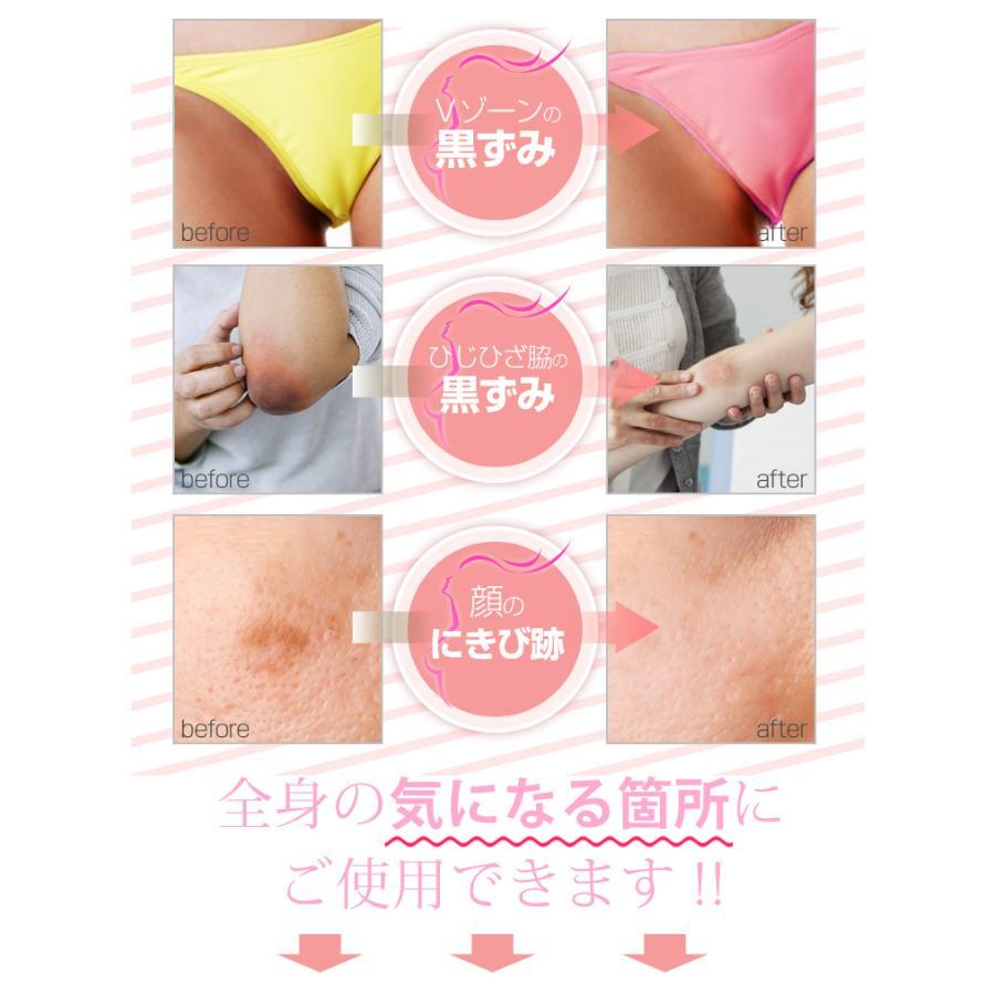 ボディケア バストケア Angel BabyPink エンジェル ベビー ピンク 医薬