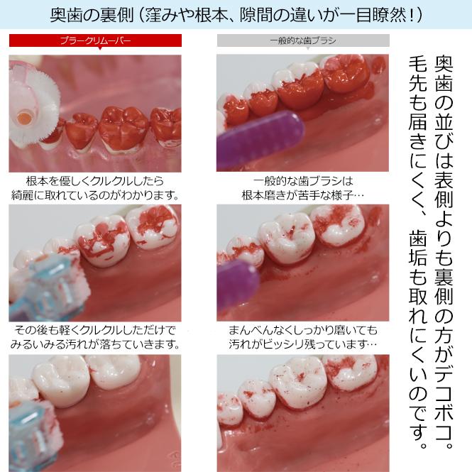 クルン 歯ブラシ プラークリムーバー 日本製 大人 キッズ 子供 銀