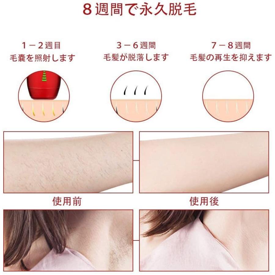 お1人様1点限り 光脱毛器 Hatsubi わき ダークレッド 全身ムダ毛処理 顔 足 Vio 背中 腕 髭 ボディ フェイスケア