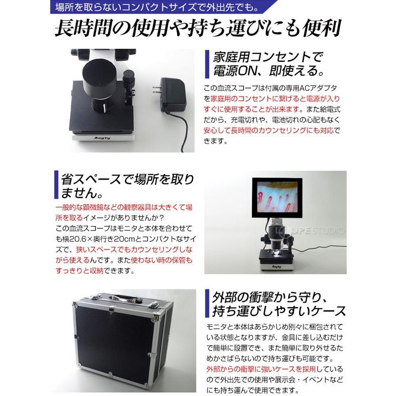 顕微鏡 血流スコープ サラミール 血管 検査 毛細血管 無採血 血 顕微鏡 血流スコープ サラミール 血管 検査 毛細血管 無採血 血