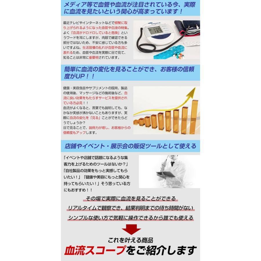 顕微鏡 血流スコープ サラミール 血管 検査 毛細血管 無採血 血 顕微鏡 血流スコープ サラミール 血管 検査 毛細血管 無採血 血