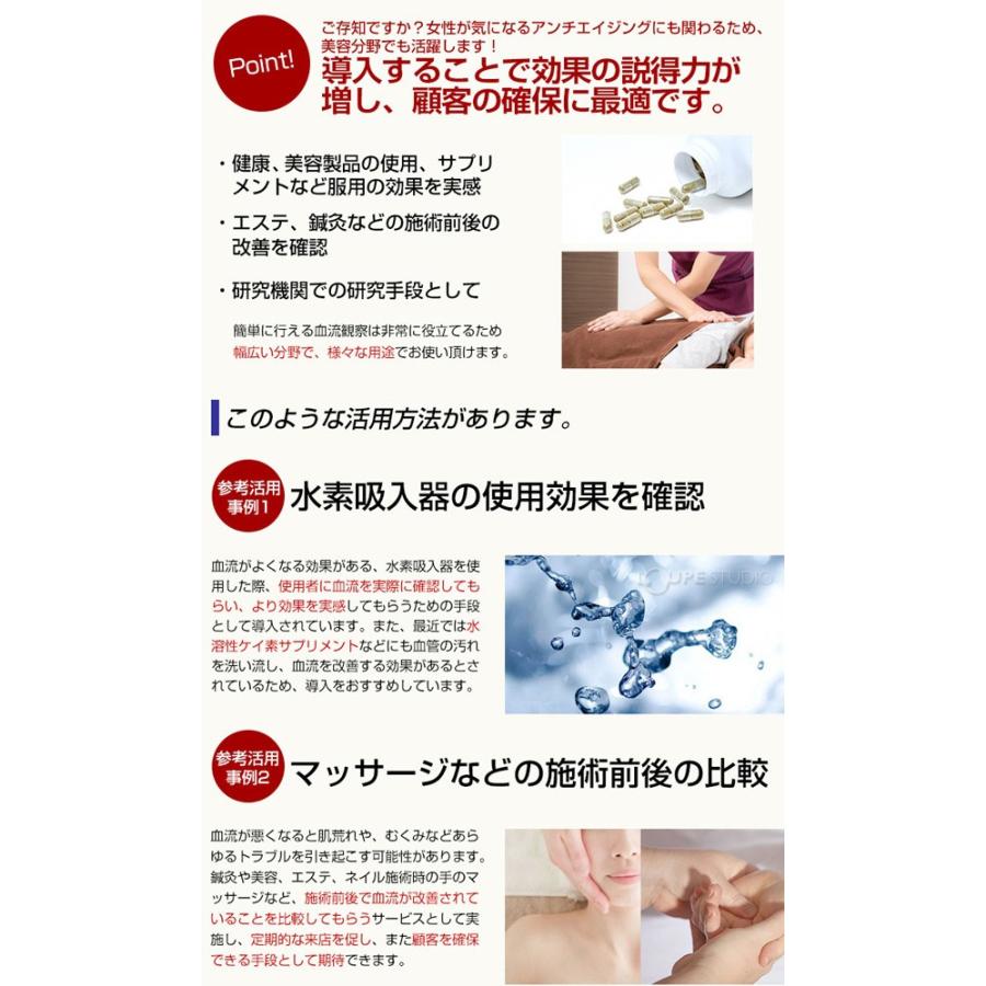 顕微鏡 血流スコープ サラミール 血管 検査 毛細血管 無採血 血 顕微鏡 血流スコープ サラミール 血管 検査 毛細血管 無採血 血