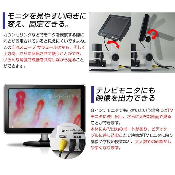 顕微鏡 血流スコープ サラミール 血管 検査 毛細血管 無採血 血 顕微鏡 血流スコープ サラミール 血管 検査 毛細血管 無採血 血