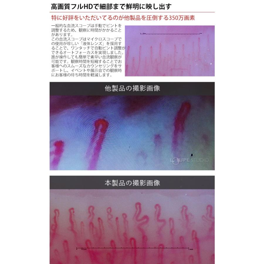 顕微鏡 血流スコープ 肌 血流観察 チェック 確認 検査 頭皮 観察機器