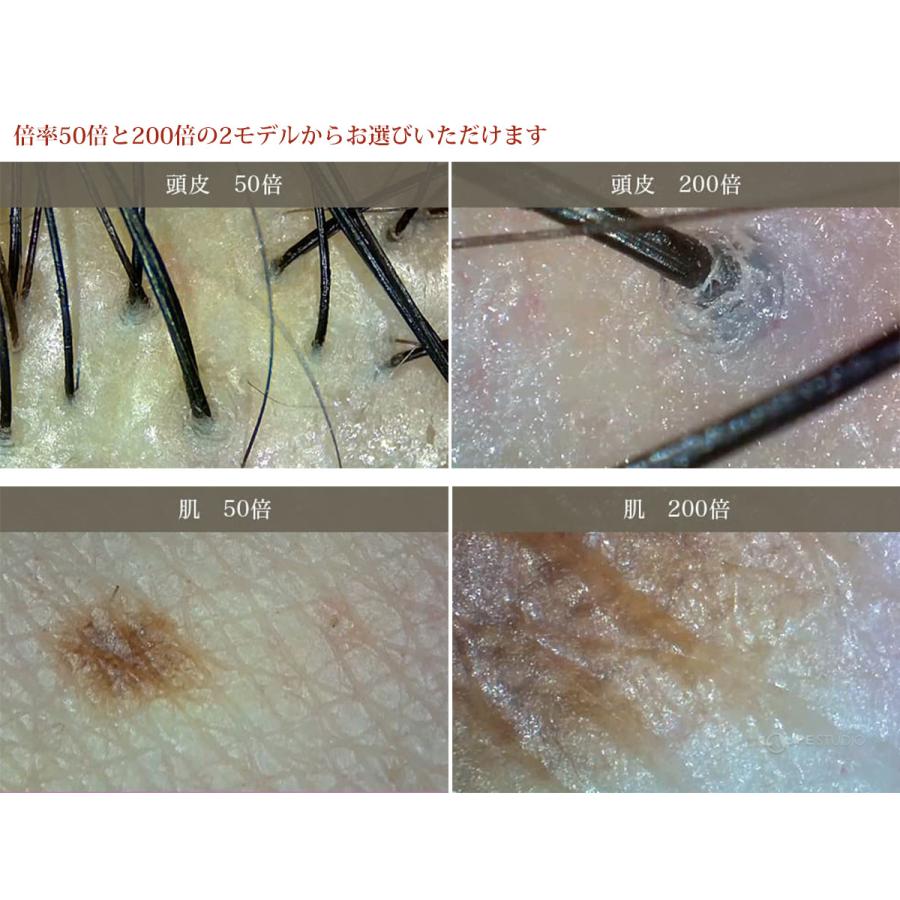 マイクロスコープ 頭皮 肌 美容 スマホ タブレット Iphone Ipad Wi Fi ワイヤレス 0倍 顕微鏡 デジタル顕微鏡 Usb おしゃ 3r 1 ルーペスタジオ 通販 Yahoo ショッピング