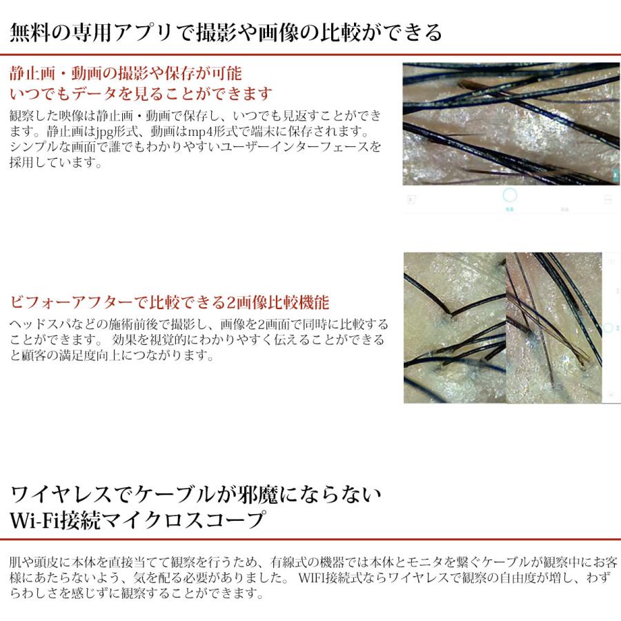 マイクロスコープ 頭皮 肌 美容 スマホ タブレット iPhone iPad