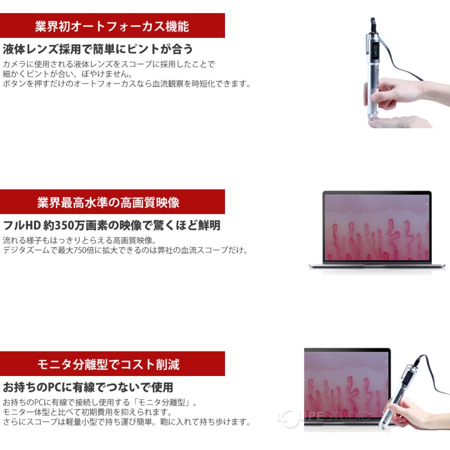 顕微鏡 頭皮 肌 指用血流観察オートフォーカスマイクロスコープ 顕微鏡 頭皮 肌 指用血流観察オートフォーカスマイクロスコープ
