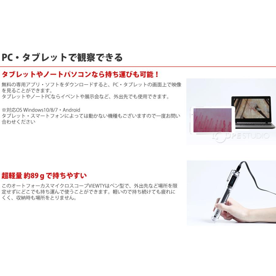 顕微鏡 頭皮 肌 指用血流観察オートフォーカスマイクロスコープ VIEWTY