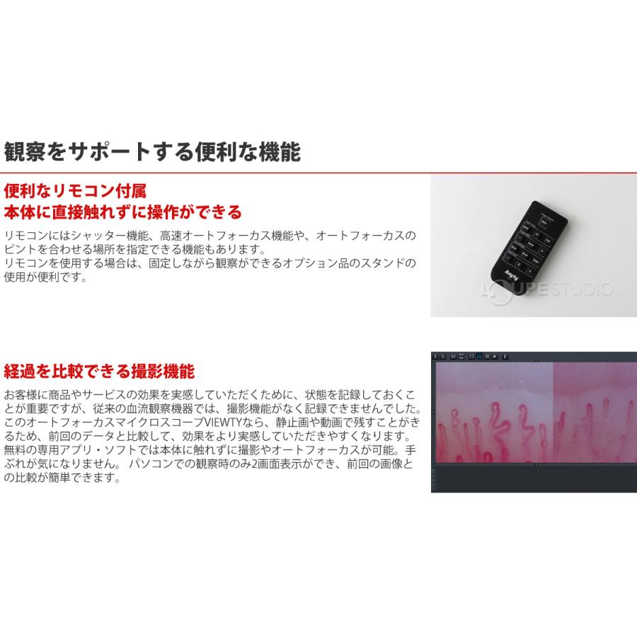 顕微鏡 頭皮 肌 指用血流観察オートフォーカスマイクロスコープ VIEWTY