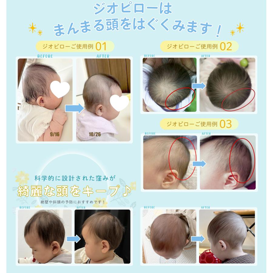 ジオピロー 公式 ベビー枕 絶壁防止 新生児 赤ちゃん ドーナツ 枕 まくら メッシュ 頭の形 絶壁 向き癖 対策 ベビー 0歳  出産祝い 出産準備 giopillowの画像
