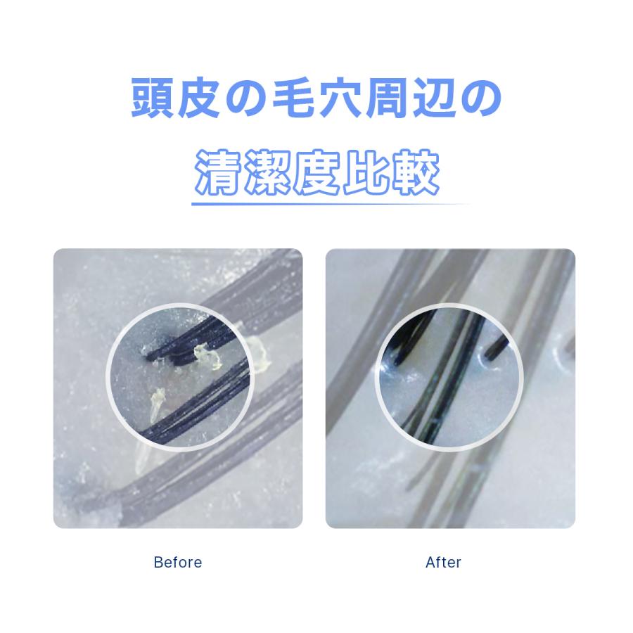 ヘッドスパ 自宅 頭皮マッサージ器 ヘッドマッサージ 頭皮ケア ブラシ ヘッド マッサージ機 Ipx7防水 頭皮 乾燥 フケ 対策 首 肩 顔 プレゼント Tech Love Tl106aw 三豊ストア 通販 Yahoo ショッピング