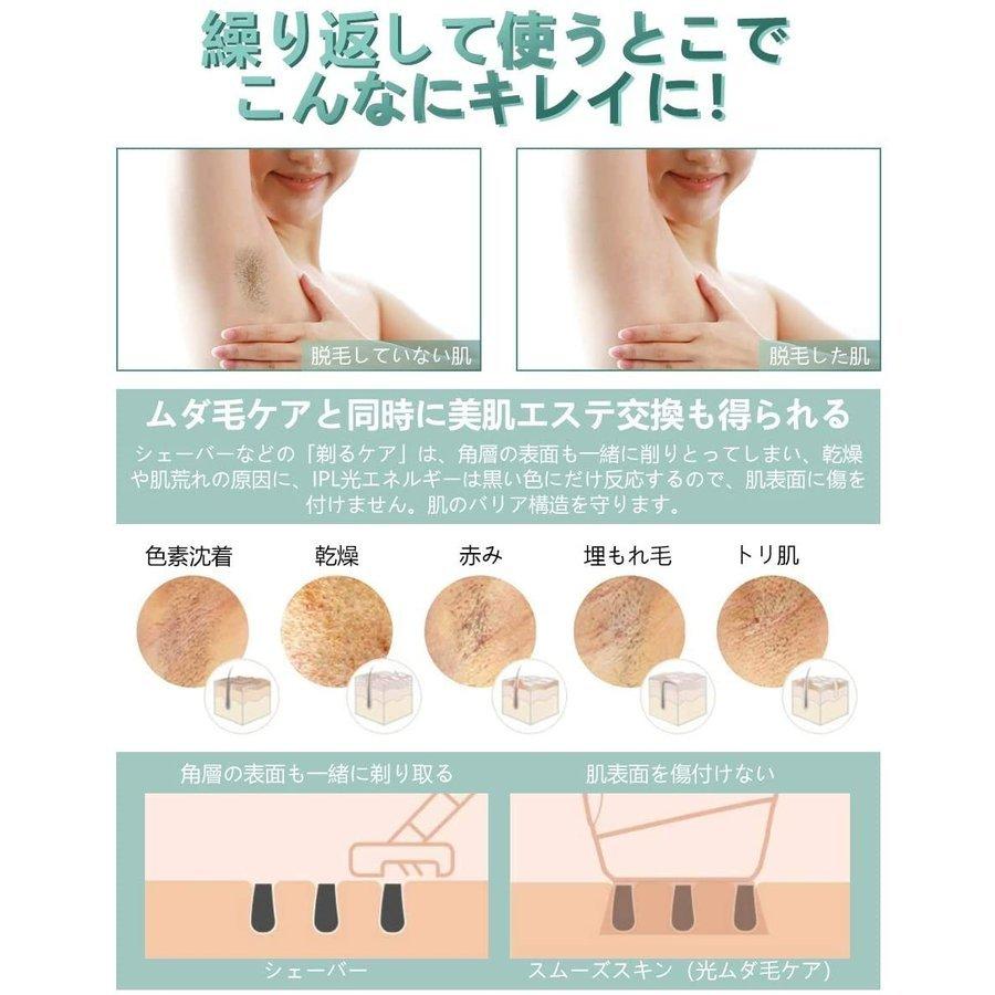 お歳暮 脱毛器 Ipl光脱毛器 冷感脱毛 99万回照射 Vio 全身脱毛 ８週間脱毛済み 美肌機能搭載 フラッシュ式 痛み無く ムダ毛処理 ヒゲ対応 全身脱毛 5段階調節 格安 Bitcoinbro Frankhawley Com
