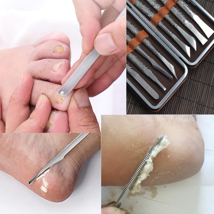 Callus Remover for Feet,8PCS Pedicure Knife,Corn Removers for Fe 並行輸入品｜lucky39｜10