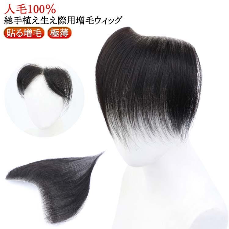 シール式 シール 貼る 生え際 部分ウィッグ 貼るウィッグ 黒 対策 M型