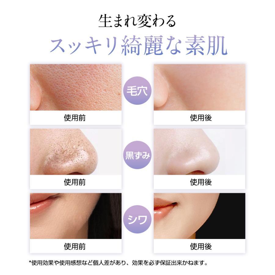 ウォーターピーリング 超音波 美顔器 EMS 防水 毛穴ケア 黒ずみ 皮脂