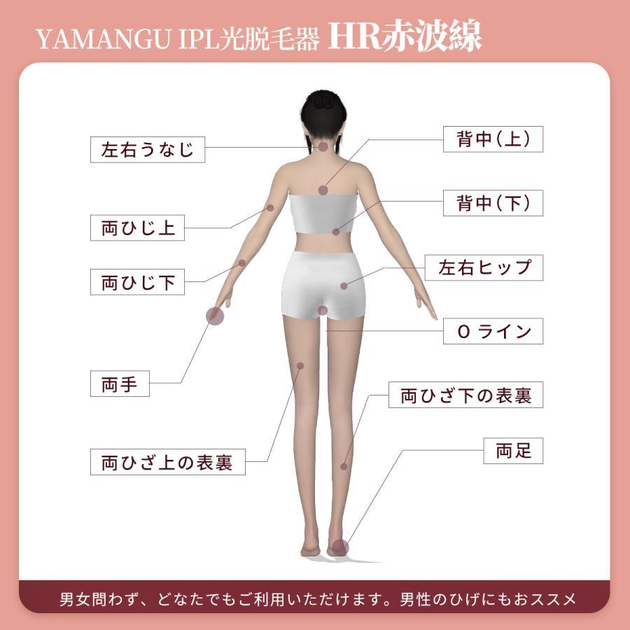 脱毛器 永久脱毛 IPL光脱毛器 VIO脱毛 フラッシュ脱毛器 冷却 全身脱毛 メンズ レディース 冷却機能 ワキ 腕 足 背中 ビキニライン 二年保証｜m-cc｜10