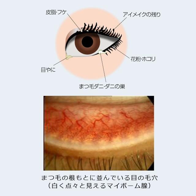 アイシャンプーロング(約1ヶ月分) まつ育を応援 目元専用シャンプー まつ毛専用シャンプー アイケア|m-medical-net|02