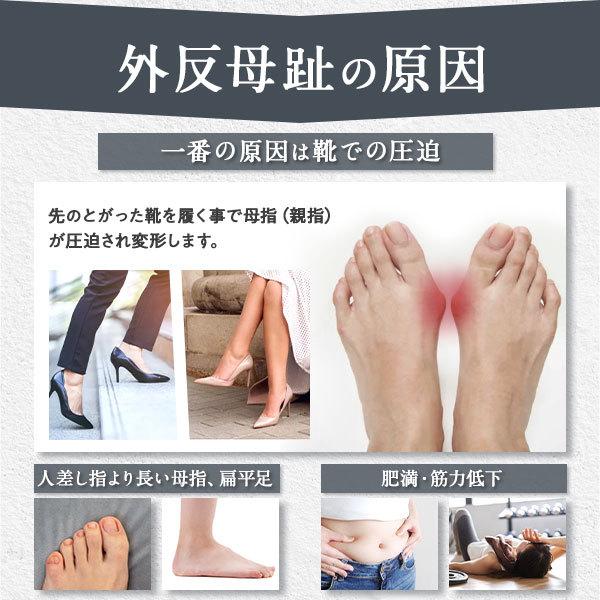 足指サポーター 外反母趾 サポーター シリコン 足指 広げる グッズ 足指パッド 保護 寝る 115 Toe Supporter M Mode 通販 Yahoo ショッピング