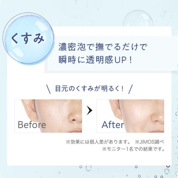 MACCHIA LABEL タンサン(炭酸)エステパックa | 毛穴 炭酸パック