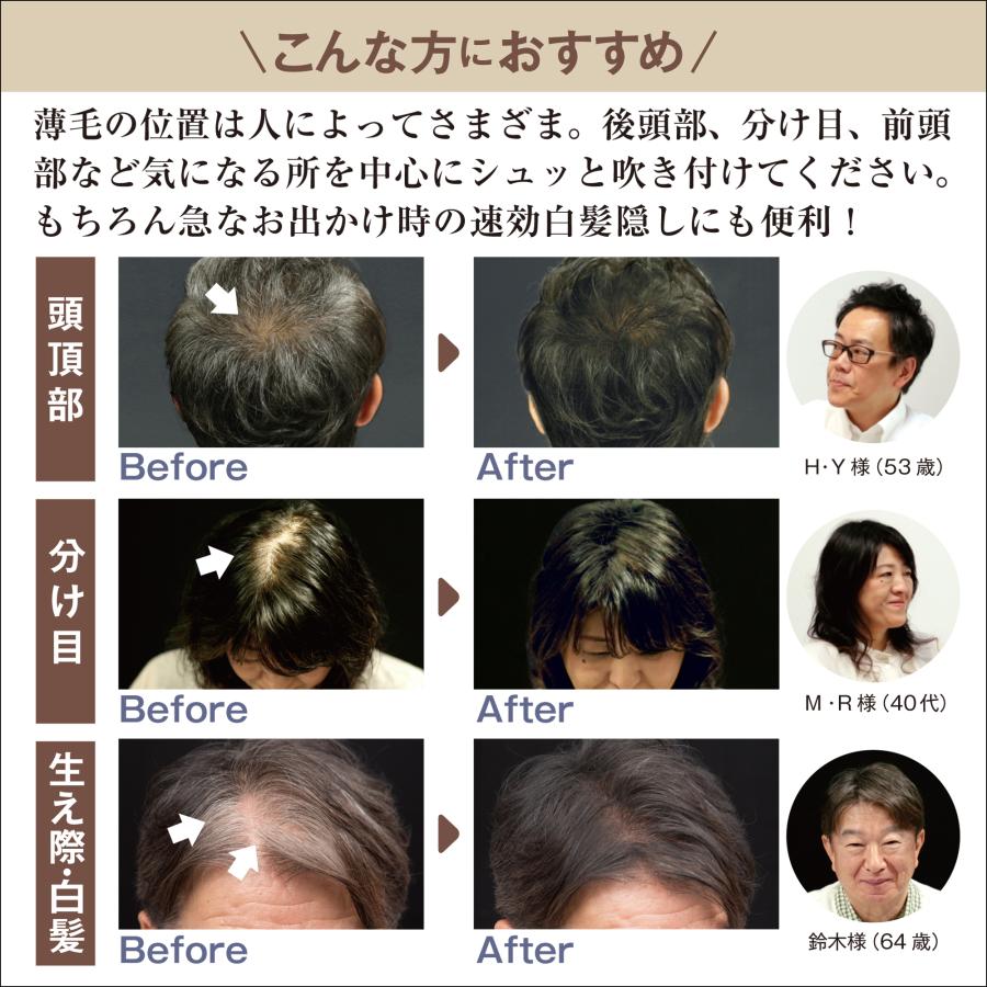 増毛スプレー 薄毛隠し 薄毛対策 白髪隠し ハゲ MAG aladdin ミニ