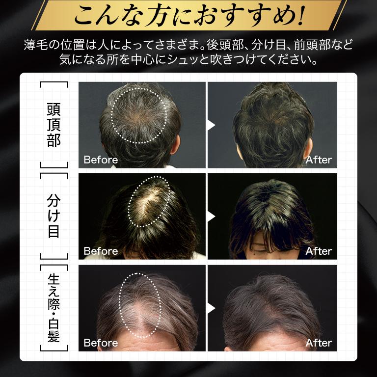 増毛スプレー 薄毛隠し 薄毛対策 白髪隠し ハゲ MAG aladdin アラジン