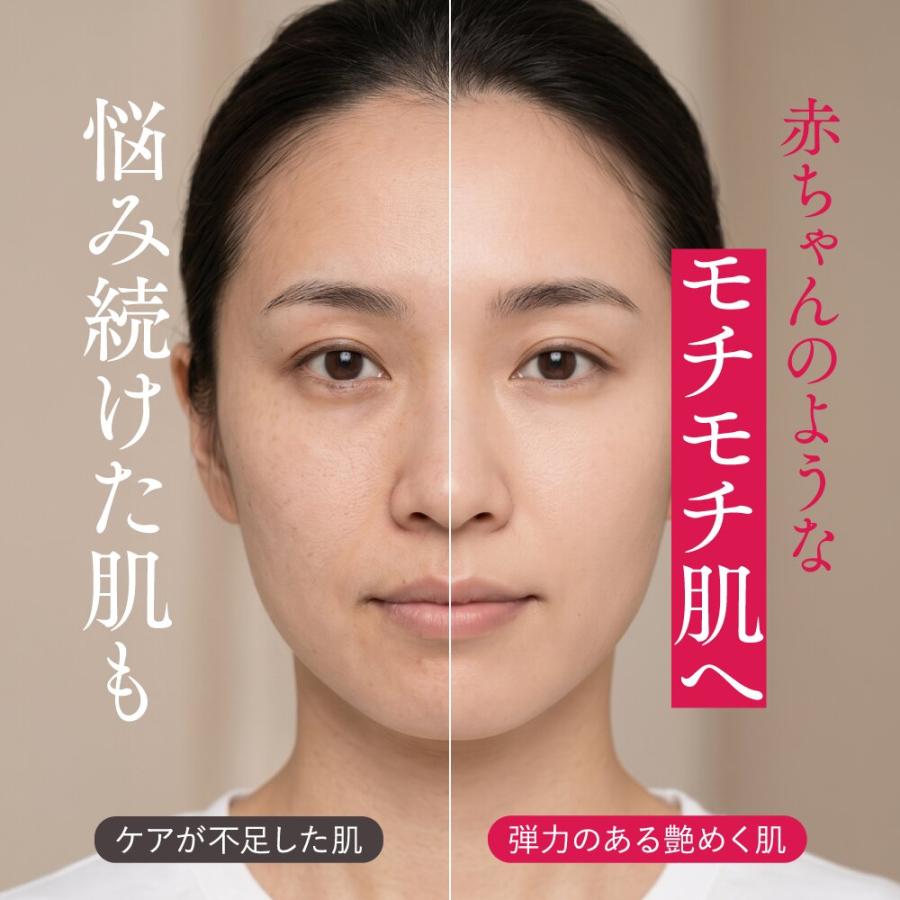 maima botanica オールインワン ミルクローション 赤ちゃん 敏感肌