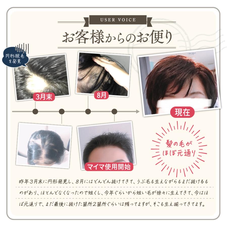 育毛剤 女性用 医薬部外品 40代 50代 60代 育毛ヘアローション 養毛 産後 脱毛シャンプー後 抜け毛 レディース 産後の女性用育毛剤 100mlマイマ maima |  | 05
