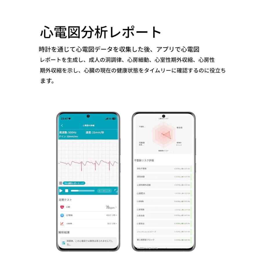 スマートウォッチ  通話機能 ECG心電図 他社9800円を 血圧測定 血中脂質 尿酸 AI診断 皮膚温 高精度心拍数 血中酸素 睡眠 着信通知 24時間健康管理 SOSの画像