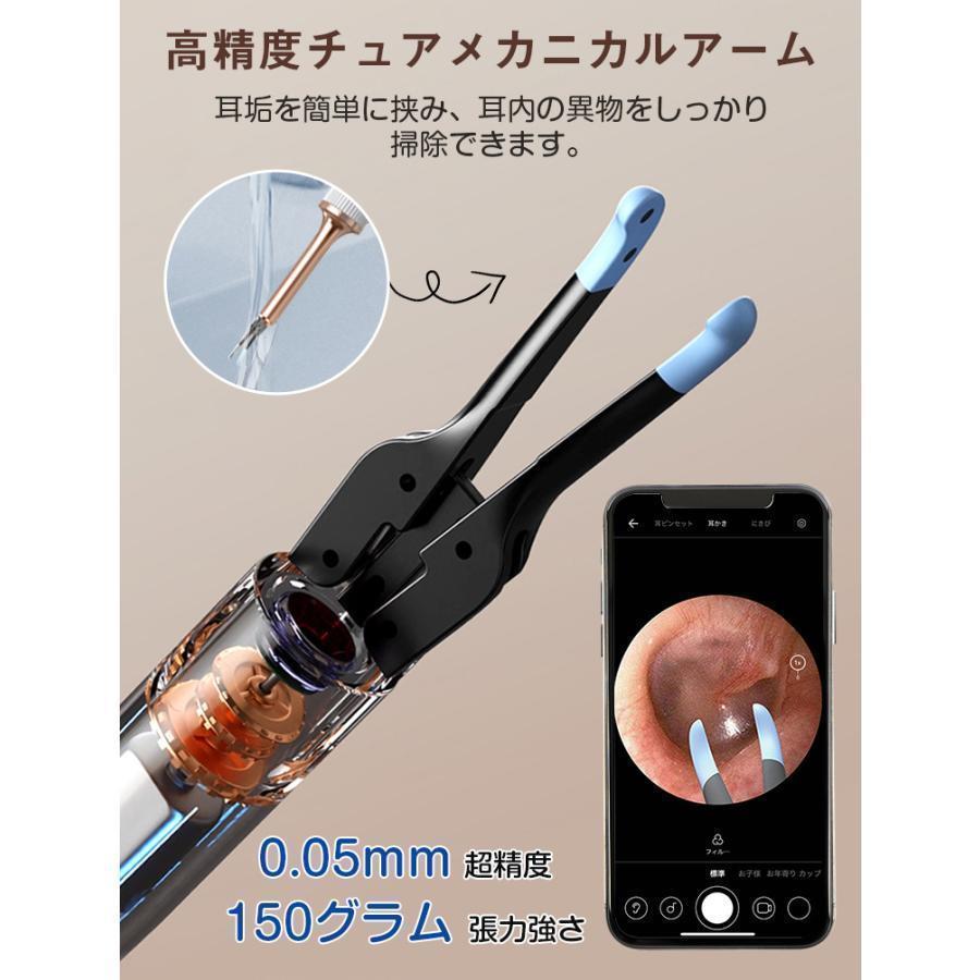 耳かき カメラ BEBIRD® PRO Note5 メカニカルアーム付き Amazon.co.jp: BEBIRD Note5 耳かき カメラ付き みみかき カメラ