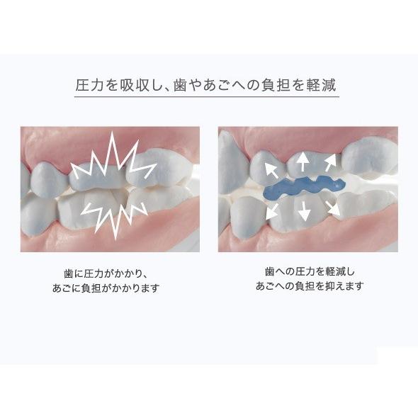 歯ぎしり マウスピース 歯ぎしりピタリ ストロング　ネコポス発送180円 |  | 03